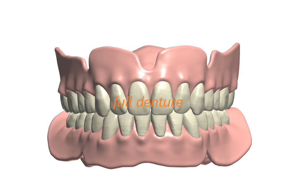 full denture